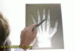 osteo plyus